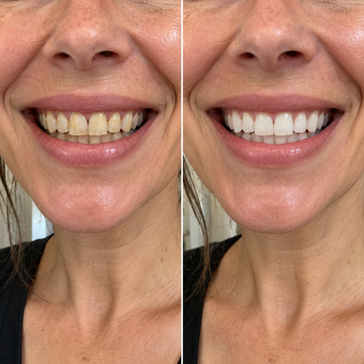 Velqura Teeth Whitening Tablets